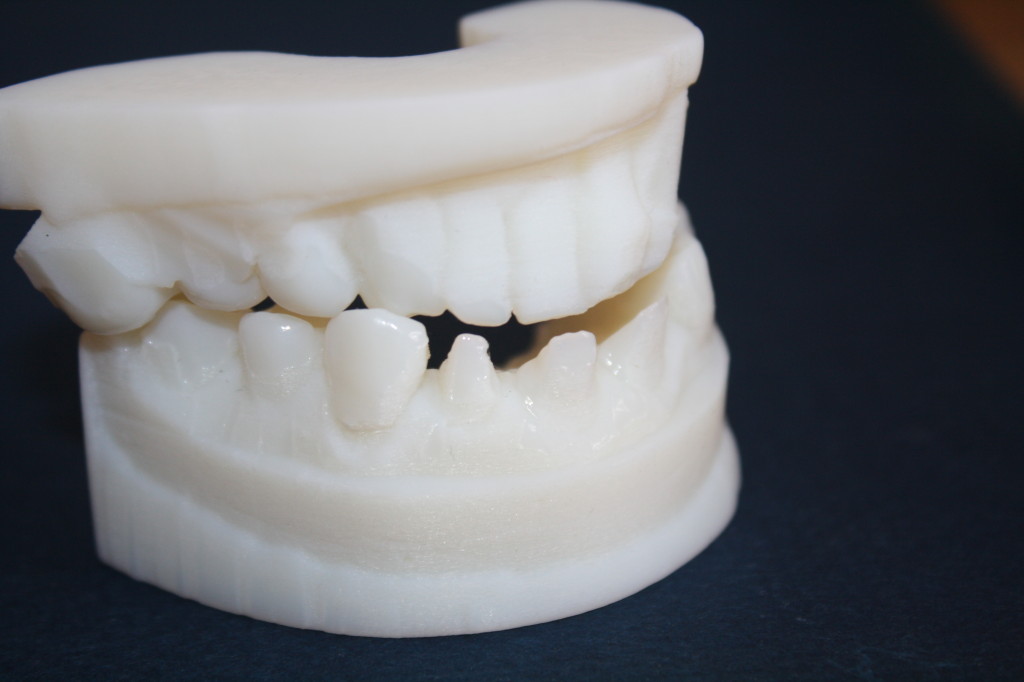 nyc_medical_dental_3d_printing_laser-cutz_brooklyn